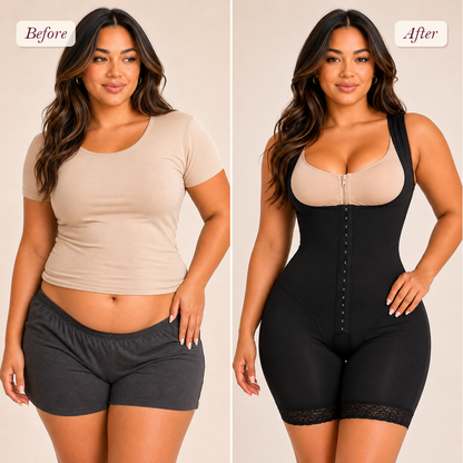 Shapelyfi Knee-High Open Bust Compression Body Shaper - before and after fit comparison